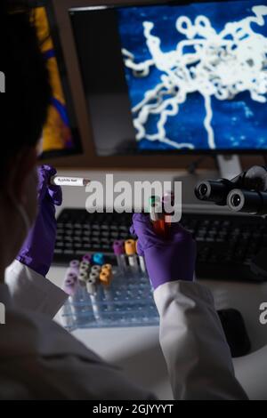 Test sanguin pour la syphilis causée par la bactérie treponema pallidum ou treponema pâle. Cette infection est transmise sexuellement. Banque D'Images