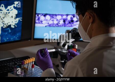 Test sanguin pour la syphilis causée par la bactérie treponema pallidum ou treponema pâle. Cette infection est transmise sexuellement. Banque D'Images