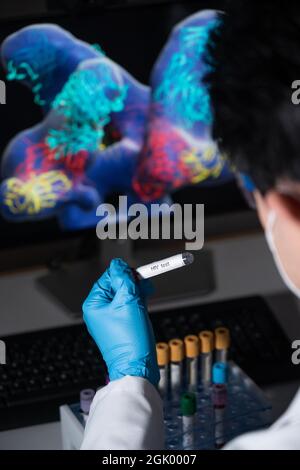 Tests Sanguins Pour Détecter Les Maladies Sexuellement Transmissibles ...