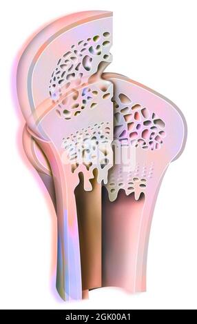Développement de l'os long : l'épiphyse s'élargit et se développe, et la tête devient arrondie. Banque D'Images