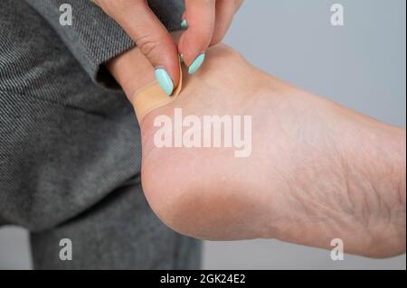 Une femme scelle un maïs sur sa jambe avec un plâtre. La jeune fille a frotté sa jambe avec des chaussures inconfortables. Banque D'Images