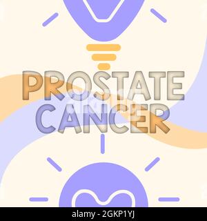 Panneau de texte indiquant cancer de la prostate. Salon d'affaires le cancer se développe dans la glande de l'appareil reproducteur masculin luminescent Light bulbe dessin Affichage Banque D'Images