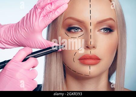 Belle femme blonde avec des marques pour la chirurgie plastique sur son visage Banque D'Images