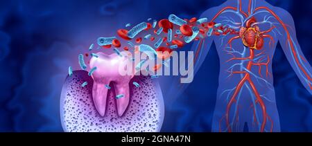 La carie dentaire et les maladies cardiaques comme un molaire malsain avec la parodontite due à un mauvais problème d'hygiène bucco-dentaire de santé comme une infection bactérienne dans le sang. Banque D'Images