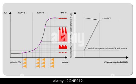 Forme d'onde ICP de surveillance de la pression intracrânienne, rendu 3d, graphique 2d, illustration Banque D'Images