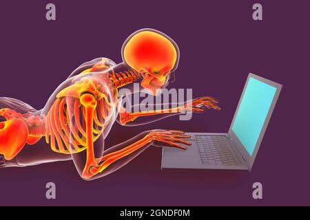 Mauvaise posture lors de l'utilisation de l'ordinateur portable, illustration Banque D'Images
