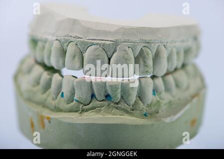 Gypse modèle dentaire des dents humaines. Gros plan. Banque D'Images