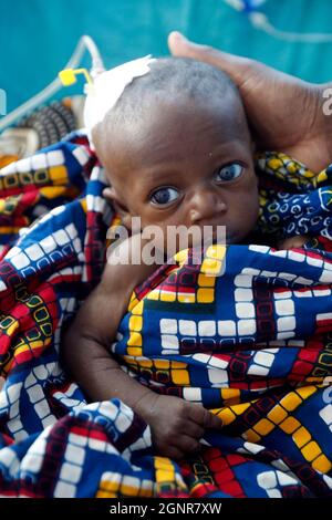 Hôpital africain. Service pédiatrique. Enfant en unité de soins intensifs. Bénin. Banque D'Images