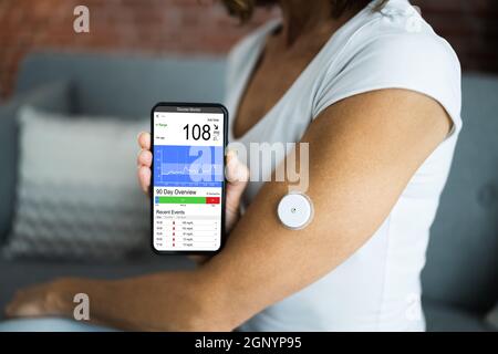 Patient utilisant un test continu de glycémie Banque D'Images