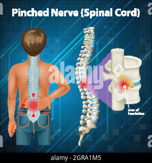 Schéma montrant la moelle épinière Illustration de Vecteur