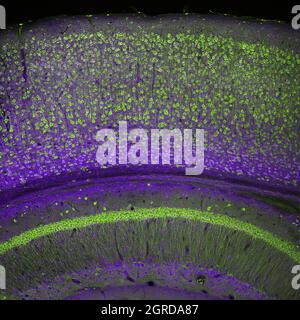 Cortex cérébral et partie de l'hippocampe sous elle dans une section d'un cerveau de souris, marqué par immunofluorescence et enregistré avec laser confocal Banque D'Images