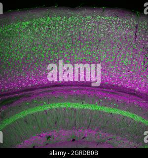 Cortex cérébral et partie de l'hippocampe sous elle dans une section d'un cerveau de souris, marqué par immunofluorescence et enregistré avec laser confocal Banque D'Images
