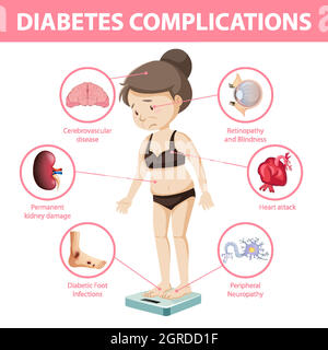 Infographie sur les complications du diabète Illustration de Vecteur