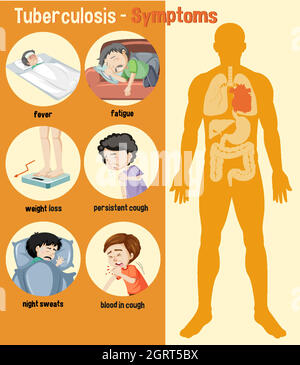 Infographie sur les symptômes de la tuberculose Illustration de Vecteur