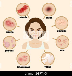 Diagramme montrant différentes maladies Illustration de Vecteur