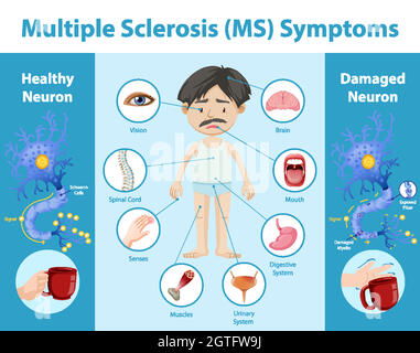 Infographie sur les symptômes de la sclérose en plaques (SEP) Illustration de Vecteur