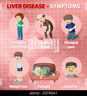 Symptômes de la maladie du foie style dessin animé style infographie Illustration de Vecteur
