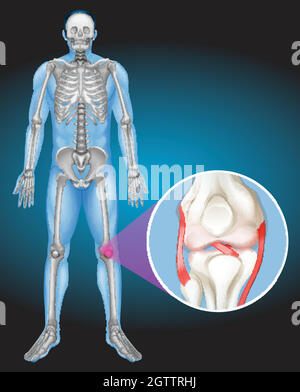 Corps humain et douleur au genou Illustration de Vecteur