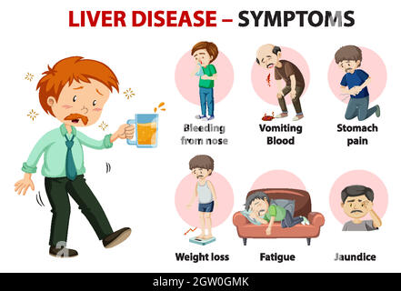 Symptômes de la maladie du foie style dessin animé style infographie Illustration de Vecteur
