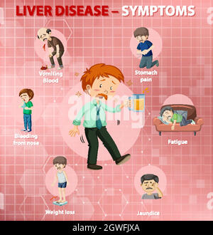 Symptômes de la maladie du foie style dessin animé style infographie Illustration de Vecteur