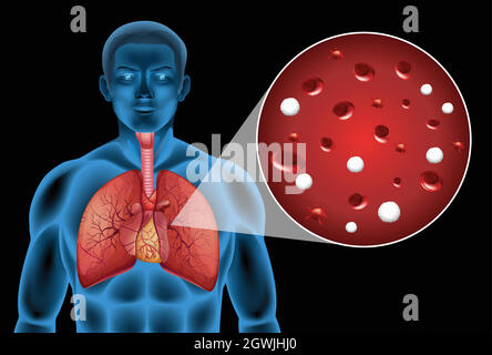 Cellules agrandies sur les poumons Illustration de Vecteur