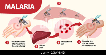 Infographie sur les symptômes du paludisme Illustration de Vecteur