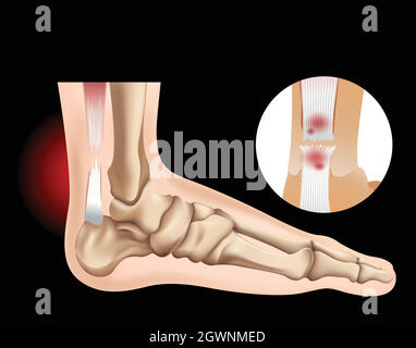 Pied humain avec tendon lacrymal Illustration de Vecteur