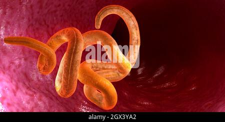 Nématode tordu unique à l'intérieur de l'intestin sur fond noir - illustration 3d Banque D'Images