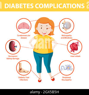 Infographie sur les complications du diabète Illustration de Vecteur