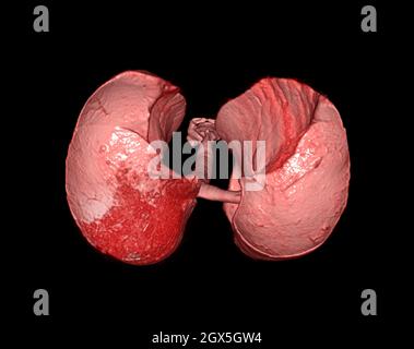 rendus 3d des poumons humains montrant le système respiratoire. Banque D'Images