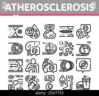 Atherosclerosis Vessel Collection Icons Set illustrations vectorielles Illustration de Vecteur