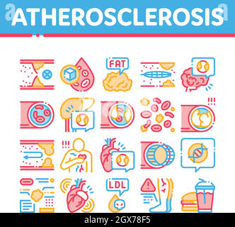 Atherosclerosis Vessel Collection Icons Set illustrations vectorielles Illustration de Vecteur