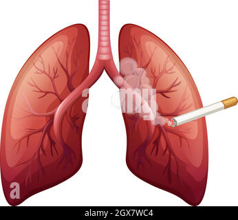 Cancer du poumon avec fumée Illustration de Vecteur