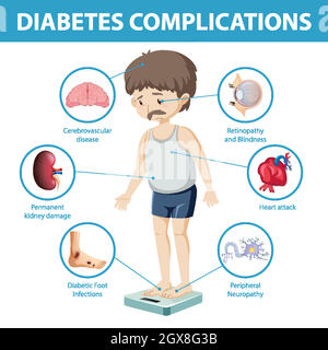 Infographie sur les complications du diabète Illustration de Vecteur