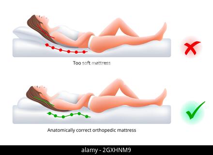 Choix d'un matelas orthopédique pour dormir - position de sommeil correcte et incorrecte au dos, illustration vectorielle. Illustration de Vecteur