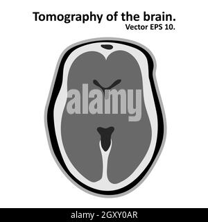 Imagerie par résonance magnétique du cerveau. Coupe transversale du cerveau avec IRM / TDM. Vecteur EPS10. Banque D'Images