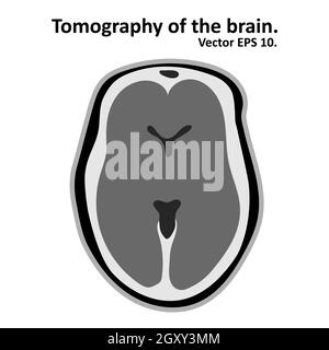Imagerie par résonance magnétique du cerveau. Coupe transversale du cerveau avec IRM / TDM. Vecteur EPS10. Illustration de Vecteur