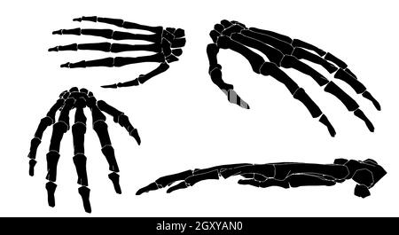 4 vues différentes de l'avant-bras en noir et blanc