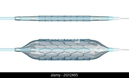 Stent déployé et collapsé prêt pour l'angioplastie isolé sur fond blanc illustration du rendu 3D.Médical, chirurgie, cardiologie, médecine, science-fiction Banque D'Images