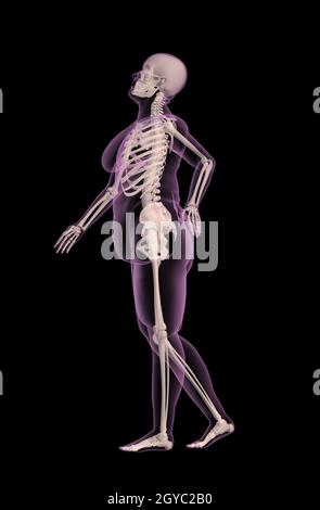 3D render of an overweight female medical skeleton avec douleur au dos Banque D'Images