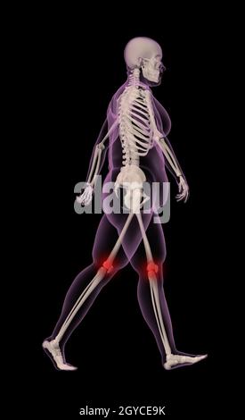 3D render of an overweight female medical skeleton marcher avec mise en évidence de l'articulation du genou Banque D'Images