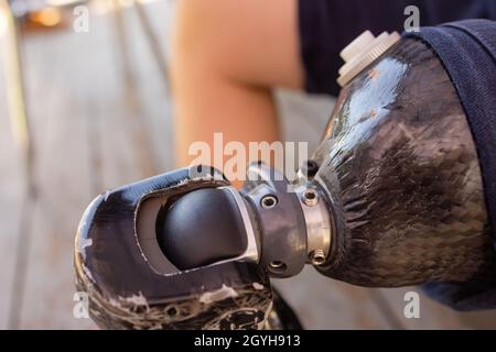 Nouvelles prothèses de jambes en aluminium pour patient amputé Banque D'Images