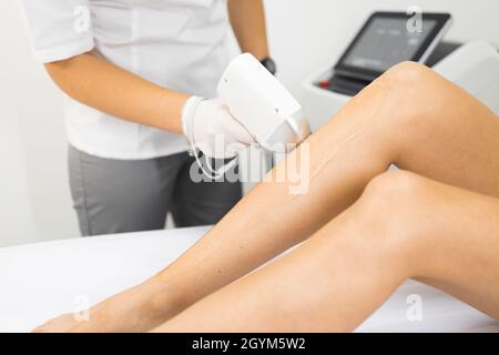 Procédure d'épilation au laser sur les jambes d'une femme Banque D'Images