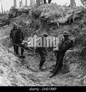 Des prisonniers allemands portent des blessés britanniques lors de l'assaut sur Trones Wood. Banque D'Images