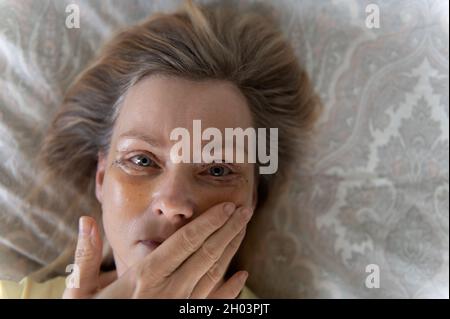 Femme d'âge moyen, selfie sept jours après une double blépharoplastie. Banque D'Images