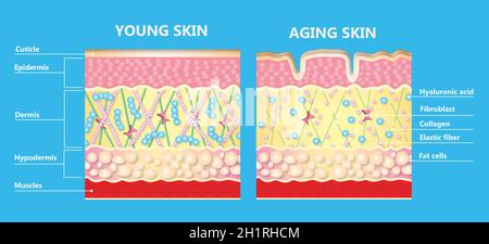 Le diagramme de la peau plus jeune et de la peau vieillissante montrant la diminution du collagène et de l'élastine cassée dans la peau plus ancienne.Illustration du vecteur d'icône Banque D'Images