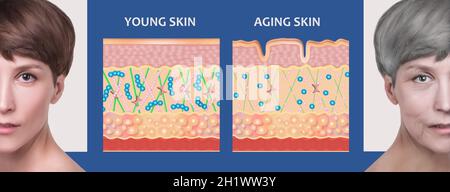 Le schéma d'une peau plus jeune et le vieillissement de la peau montrant la diminution de collagène et élastine cassé dans la peau plus ancienne. Banque D'Images