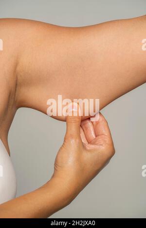 une femme se pince et montre la graisse sur ses mains sur un fond gris Banque D'Images