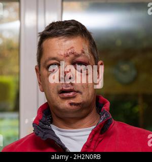 Portrait d'un homme blessé au visage. Banque D'Images