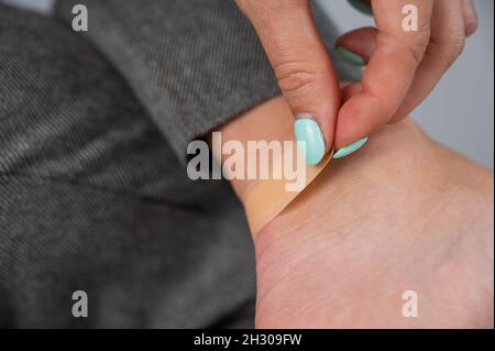 Une femme scelle un maïs sur sa jambe avec un plâtre. La jeune fille a frotté sa jambe avec des chaussures inconfortables. Banque D'Images